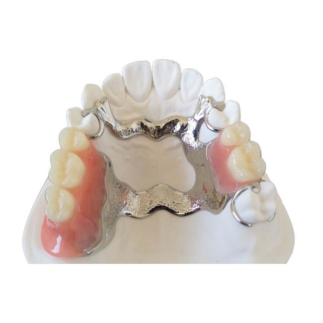 OEM 3D Printer PFM Dental Crowns Bridge High Biological Intermiscibility