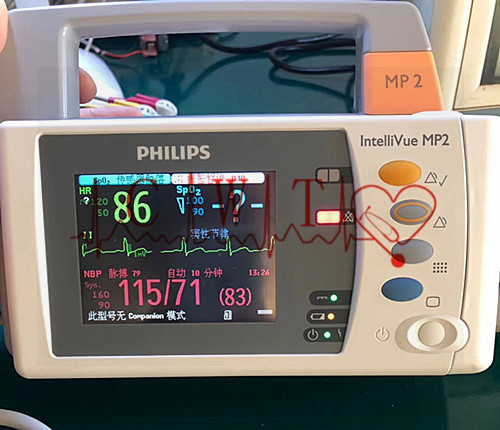 Wholesale Philip MP2 Used Patient Monitor from china suppliers