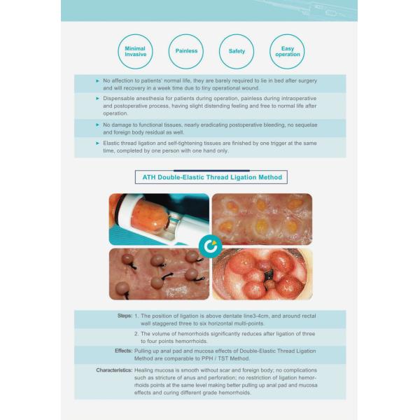 Hemorrhoidal Curved Intraluminal Stapler , Strong Tightness Disposable Circular Stapler