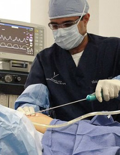 Power assisted liposuction BS-LIPS3
