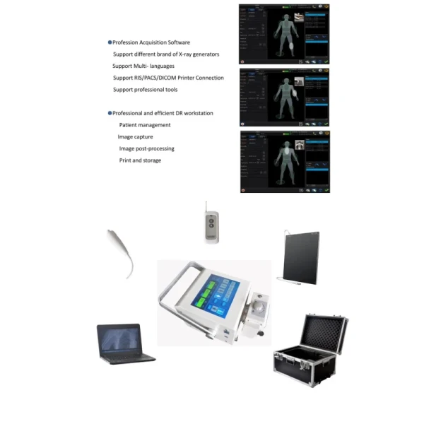 STXR-Y100 Digital Portable X Ray Machine High Frequency For Clear And Detailed Imaging