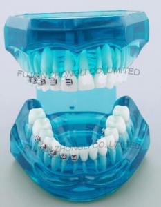 China Dental Correction Model Bracket Contrast Model Metal Brackets Ceramic Brackets on sale