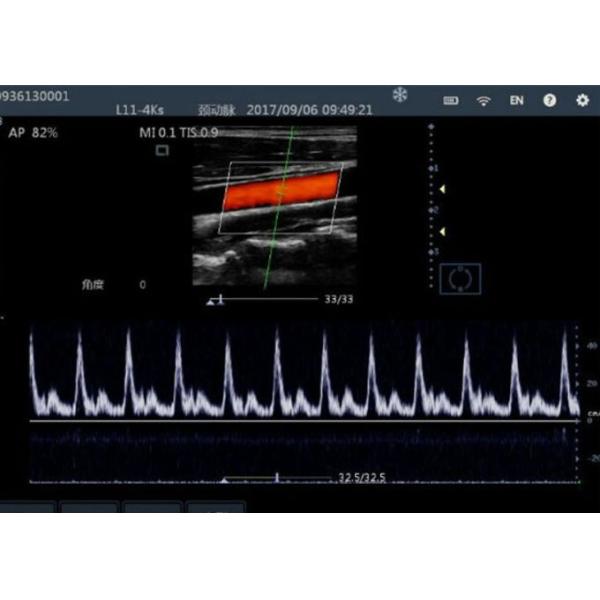Wireless Handheld Probe Color Doppler Ultrasound Scanner With 220g Weight Only
