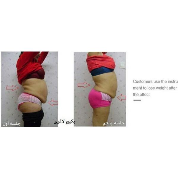 Portable two Handles Cryolipolysis Slimming Machine , Body Sculpting Machine