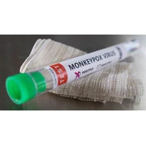 Wholesale Monkeypox Virus Detection Reagent Real Time PCR Kit from china suppliers