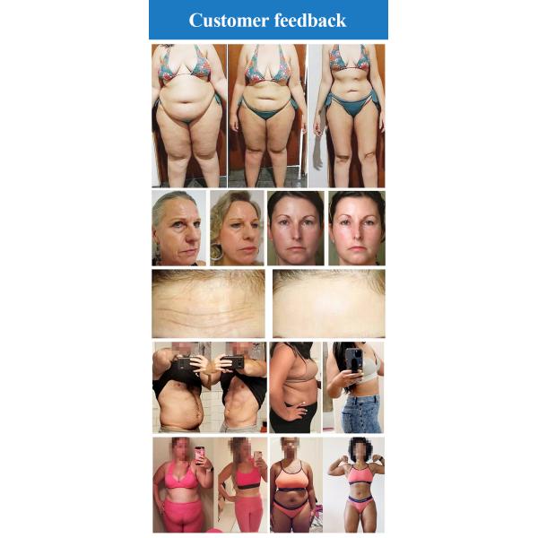 Vacuum Anti Cellulite RF Weight Loss Equipment Slimming Machine Weight Loss