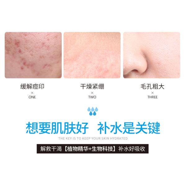 moisturizing spray after sun repairing face toner