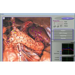 English Language Medical 3d Mra Body Tester Health Analyzer