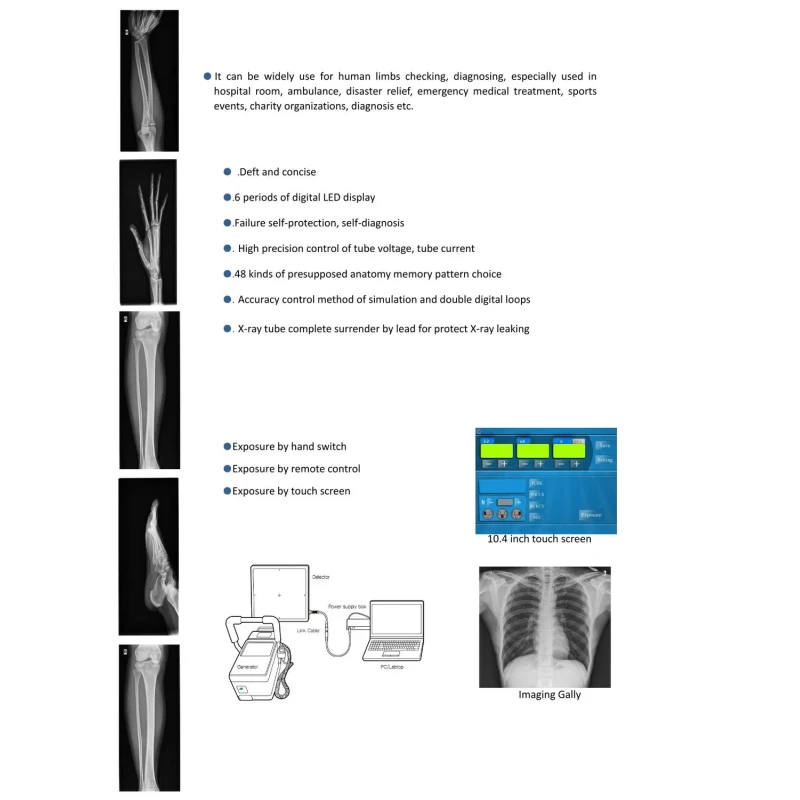 STXR-Y100 Digital Portable X Ray Machine High Frequency For Clear And Detailed Imaging