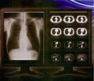 China Bright Clear Digital X Ray Film , Konida Medical Laser Transparency Film on sale