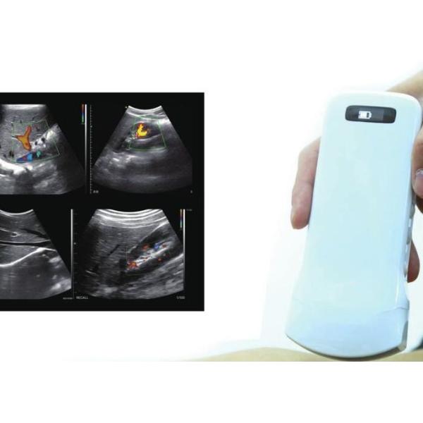 Pregnancy Wifi Color Doppler Ultrasound Scanner With Ob / Gyn Measurement