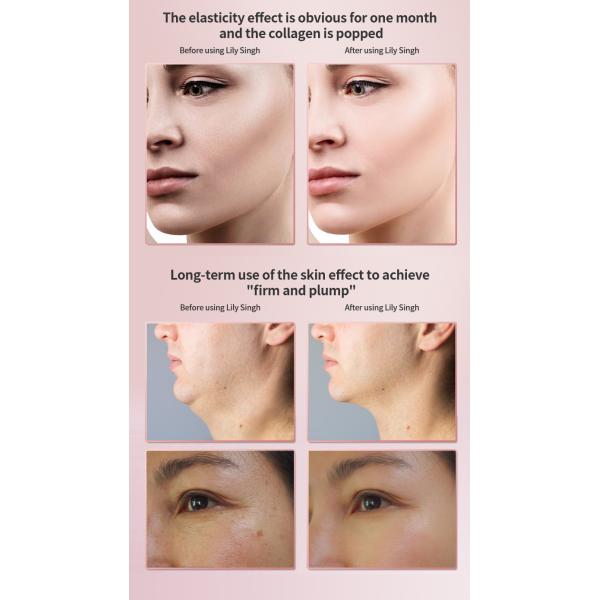 High-end Salon Rf Beauty Equipment Professional Facial Rejuvenation Lifting Machine Wrinkle Removal Beauty Instrument