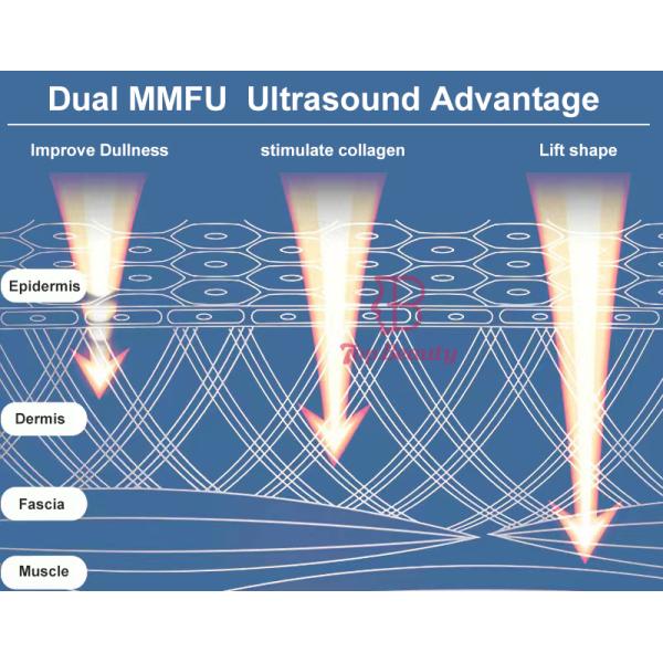 Ultrasonic 4 In 1 Vmax Mmfu Facial Wrinkle Remover Machine With Dual Handles