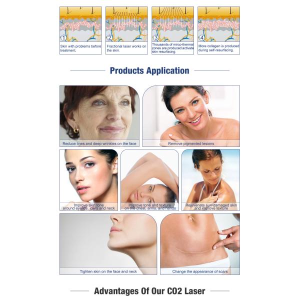 Fractional co2 laser scar removal/Co2 fractional laser /fractional Co2 laser
