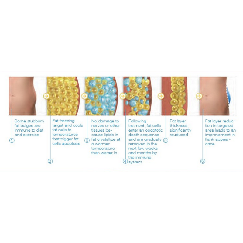 Portable two Handles Cryolipolysis Slimming Machine , Body Sculpting Machine
