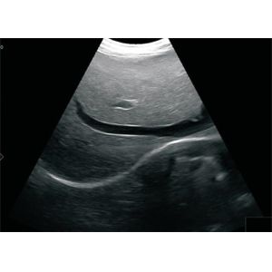 Wholesale 12 &quot; LCD Screen Portable Ultrasound Device Digital High Resolution With B, B+B, 4B, B/M M Modes from china suppliers