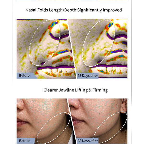 Microcurrent Facial Beauty Device Red Light Therapy Facial Massage