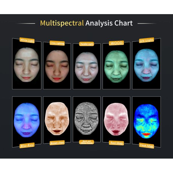 Automated Reasoning LED Skin Scanner Analysis for Sun Spot Analyse From 20 Face Problematic Features AI-Powered Report