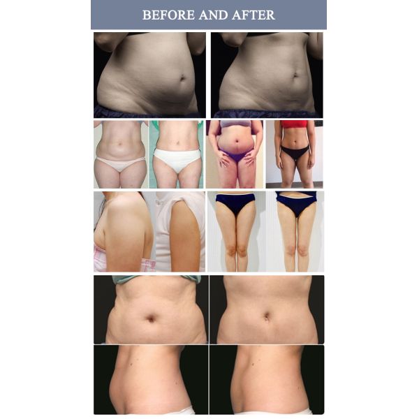 Cellulite Reduction Lipo Laser Slimming Machine 650nm with 10.4 inch touch screen