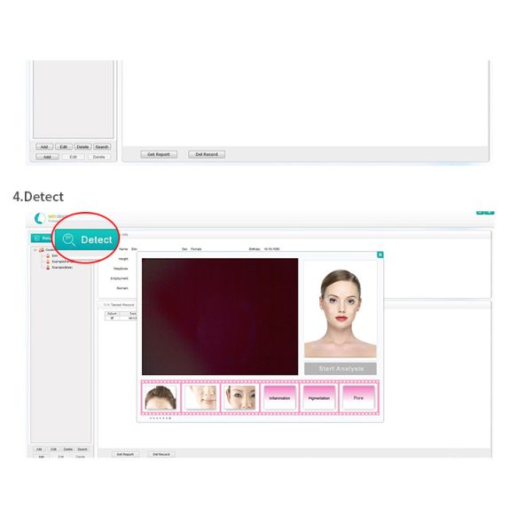 Smart Usb Skin Analysis Machine Facial Skin Camera Moisture Scanner With Software