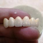 China Hot Sale 3D Multilayer dental Zirconia blocks disposable dental supplies
